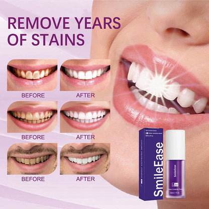 PurpleGlow Teeth Whitener